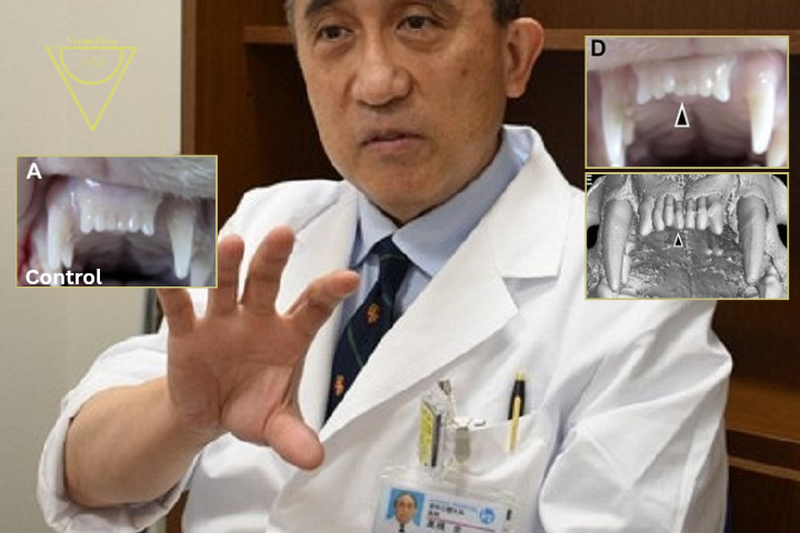 Re-Growing Missing Teeth is Now a Reality! The Science Behind Human Tooth Regeneration